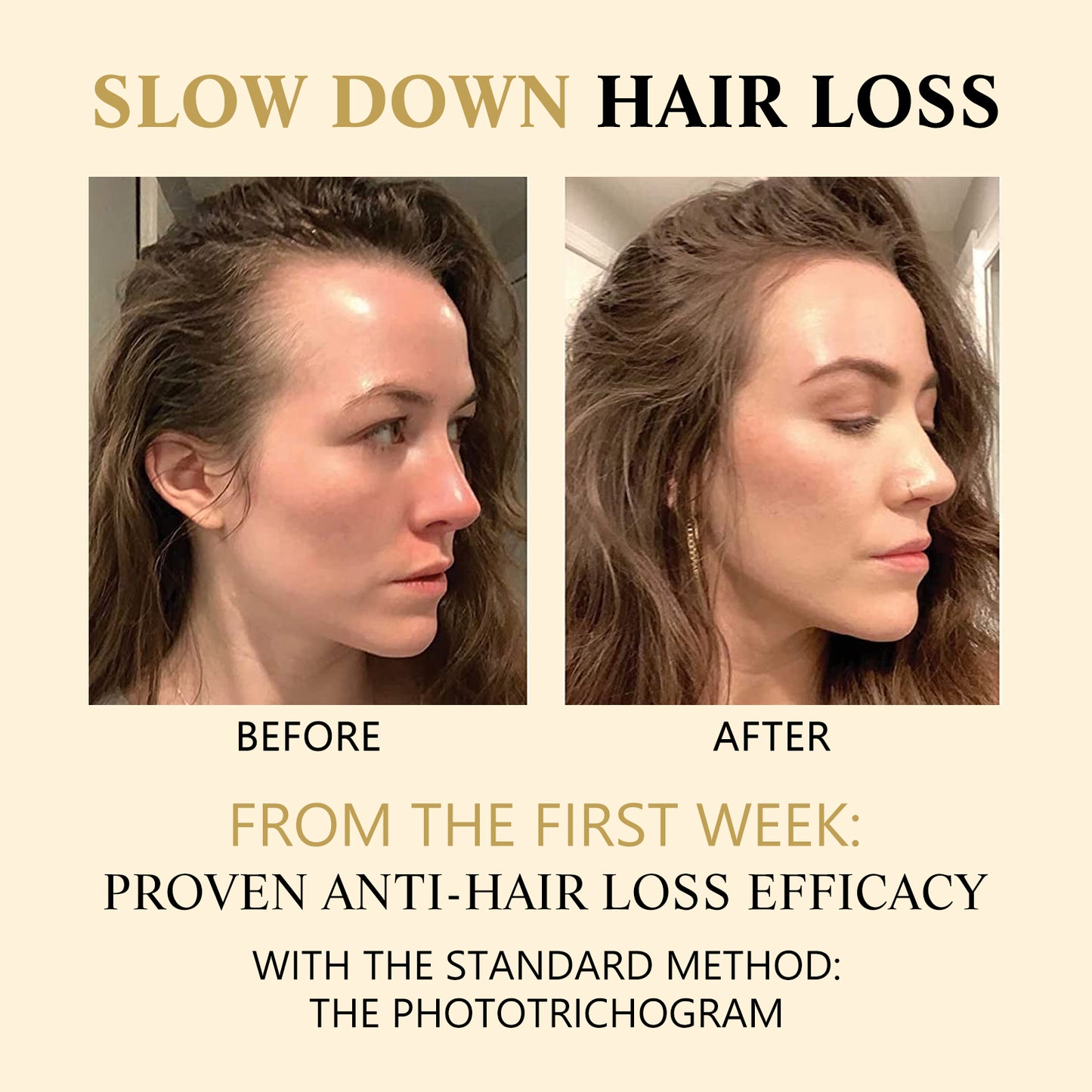 Fifuroes Hair Boost Darken Strengthen Essence, Scalp Massage Moisturizing Hair Roots Thick Smooth Hair Care Ball