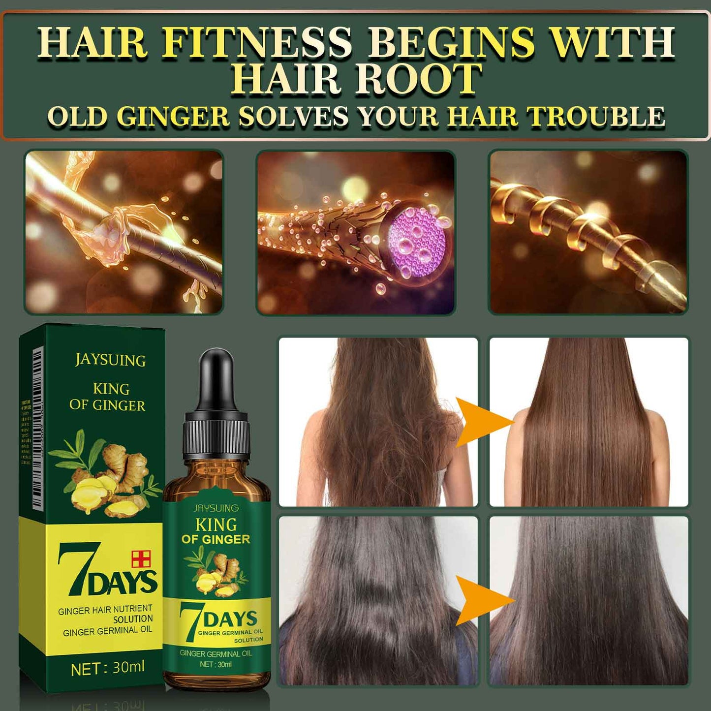 Fifuroes Ginger Hair Care Essential Oil Refreshing And Nourishing Scalp Follicles And Strengthening Hair Nutrition Solution