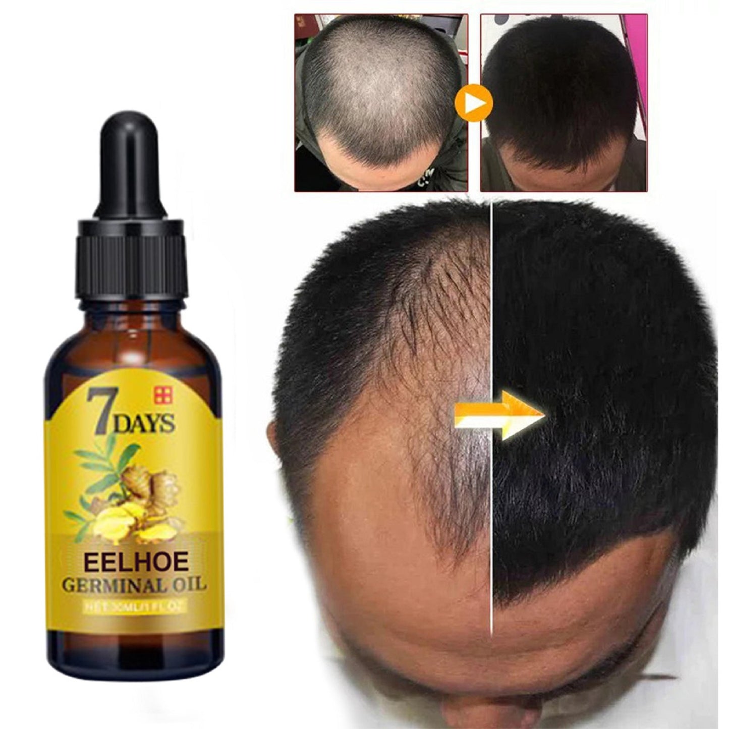 Fifuroes Ginger Hair Care Solution For Hair Nourishing And Moisturizing Hair Care For Hair Stabilizing And Preventing Hair Loss
