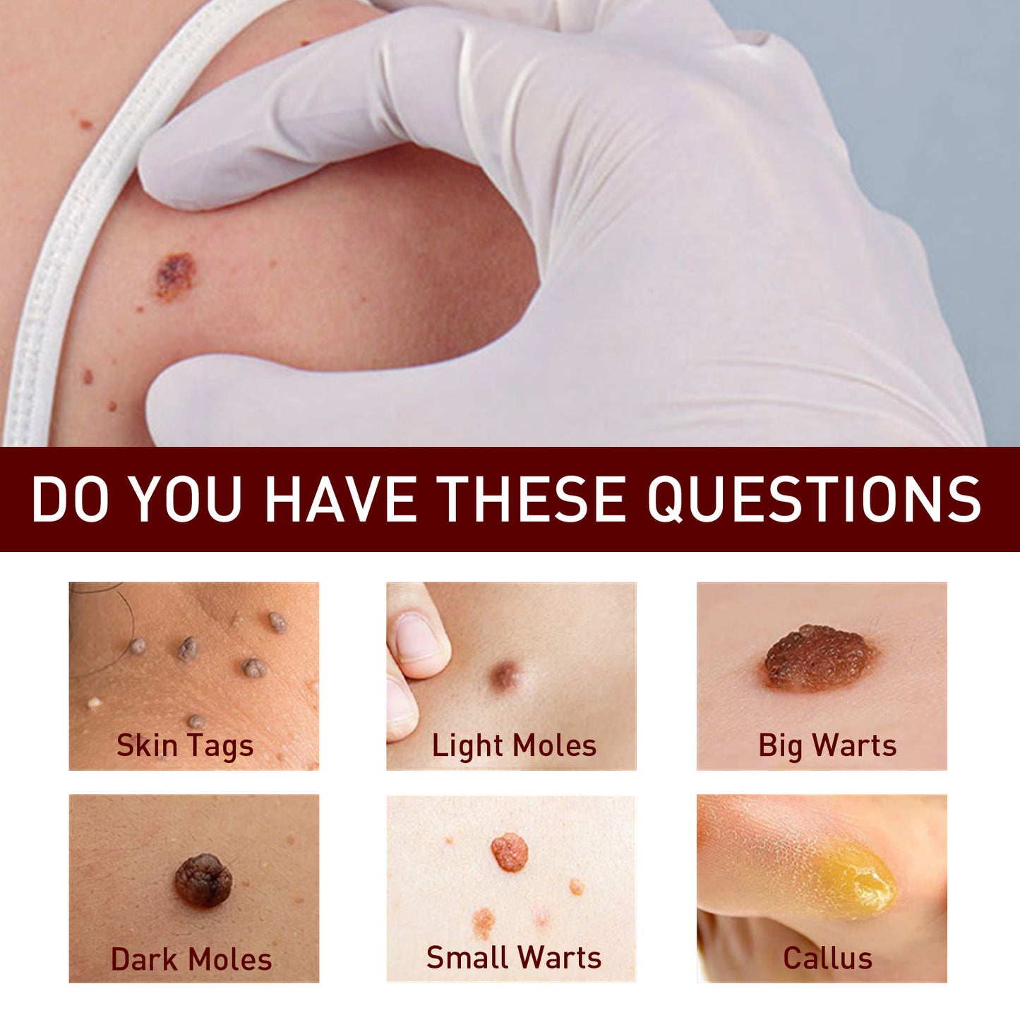 Fifuroes Wart Cream Pen, Skin Tags Gram Warts Fade Moles Corns Smooth Moisturizing Skin Repair