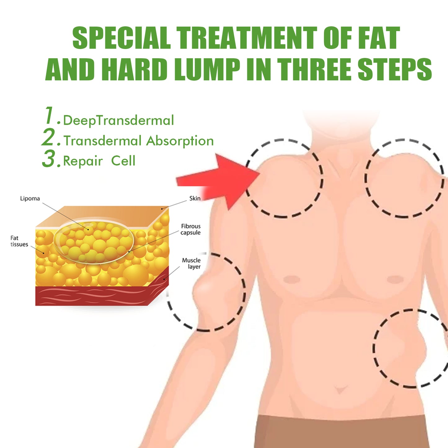 Fifuroes Fat Binding Cream, Dredge Body Of Many Kinds Of Fat Caking Tumor Subcutaneous Lumps Body Care Cream