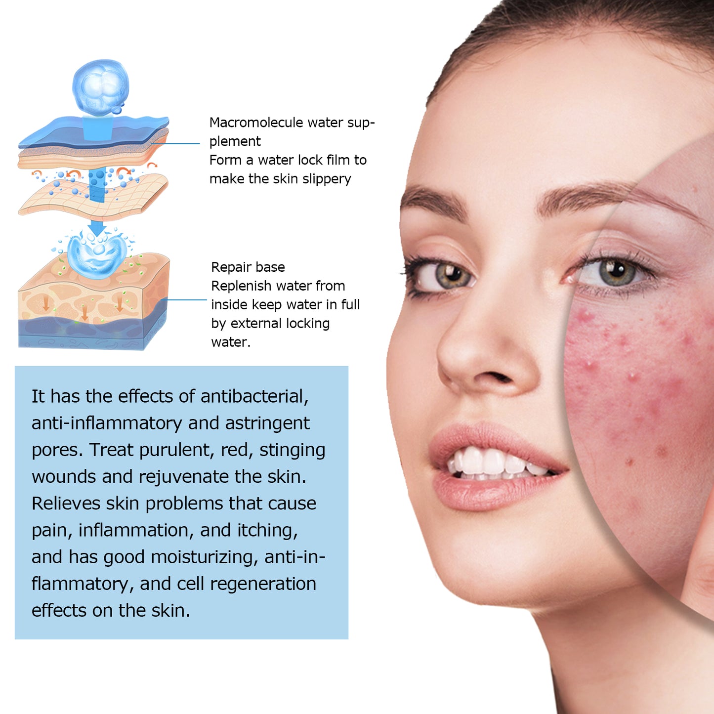 Fifuroes Hyaluronic Acid Face Serum, Moisturizing Repair Lighten Acne Mark Skin Care Whitening Essence