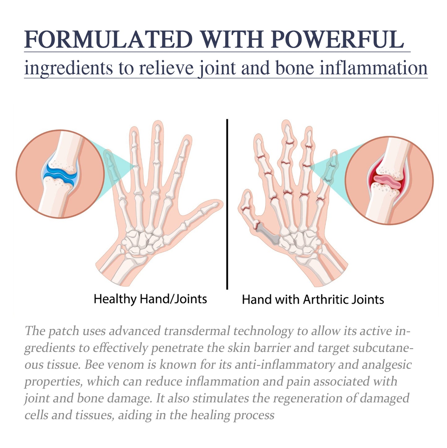 Fifuroes Bee Venom Joint Cream, Relieves Hands Legs Bones Knees Lumbar Spine Sedentary Joint Pain Body Care Cream