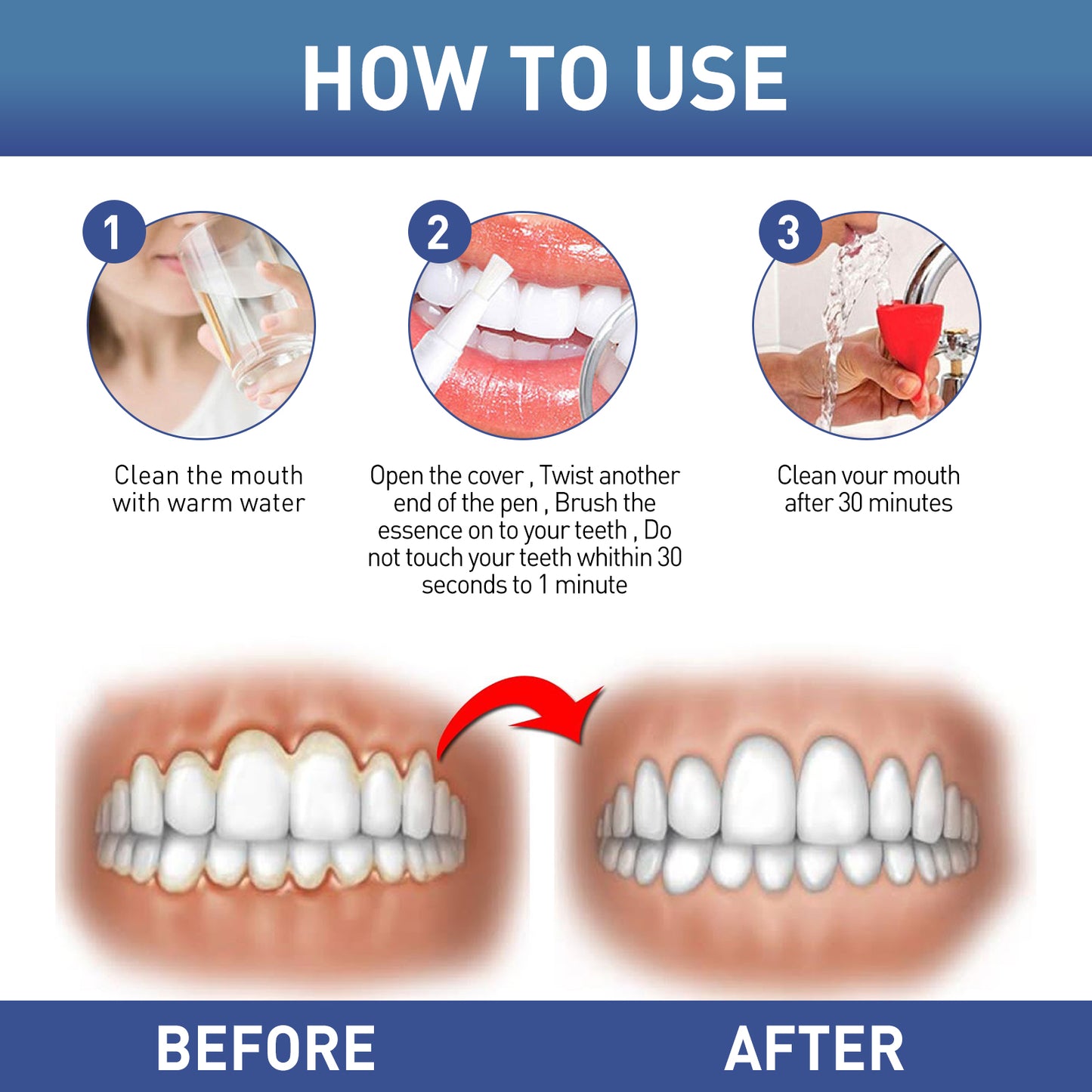 Fifuroes Gum Instant Soothing Gel, Relieve Gums Swelling And Pain Clean Teeth Plaque Stains And Whiten Teeth Gel