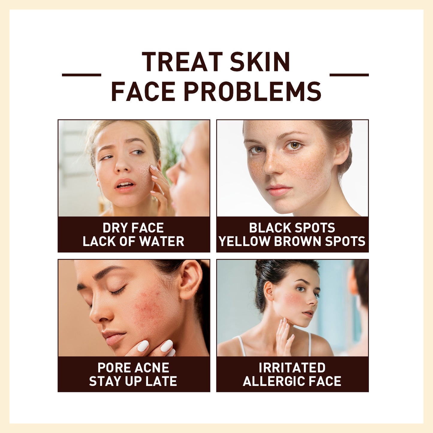 Fifuroes Rice Anti Wrinkle Essence, Repairs Skin Moisturizes Firms Whitens Essence