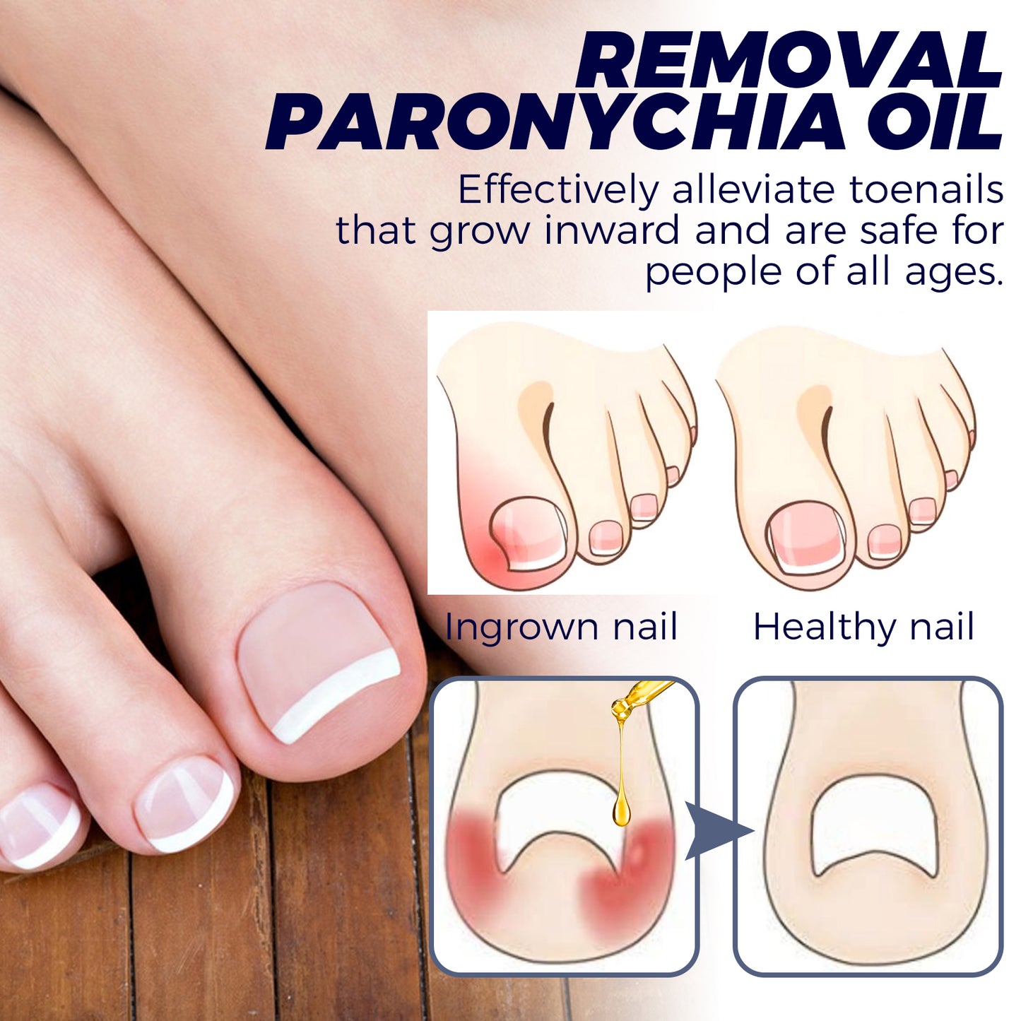 Fifuroes Nail Repair Oil Hand And Foot Repair Inlaid Toenails Soft Nails Daily Moisturizing Nail Care