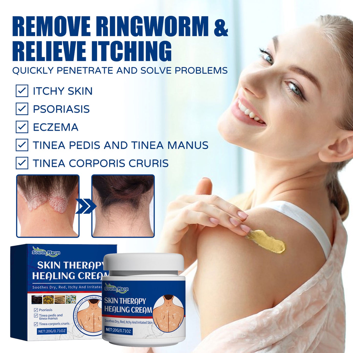 Fifuroes Skin Care Cream Gentle Ingredients Nourish Body Skin And Relieve Redness Skin Care Cream