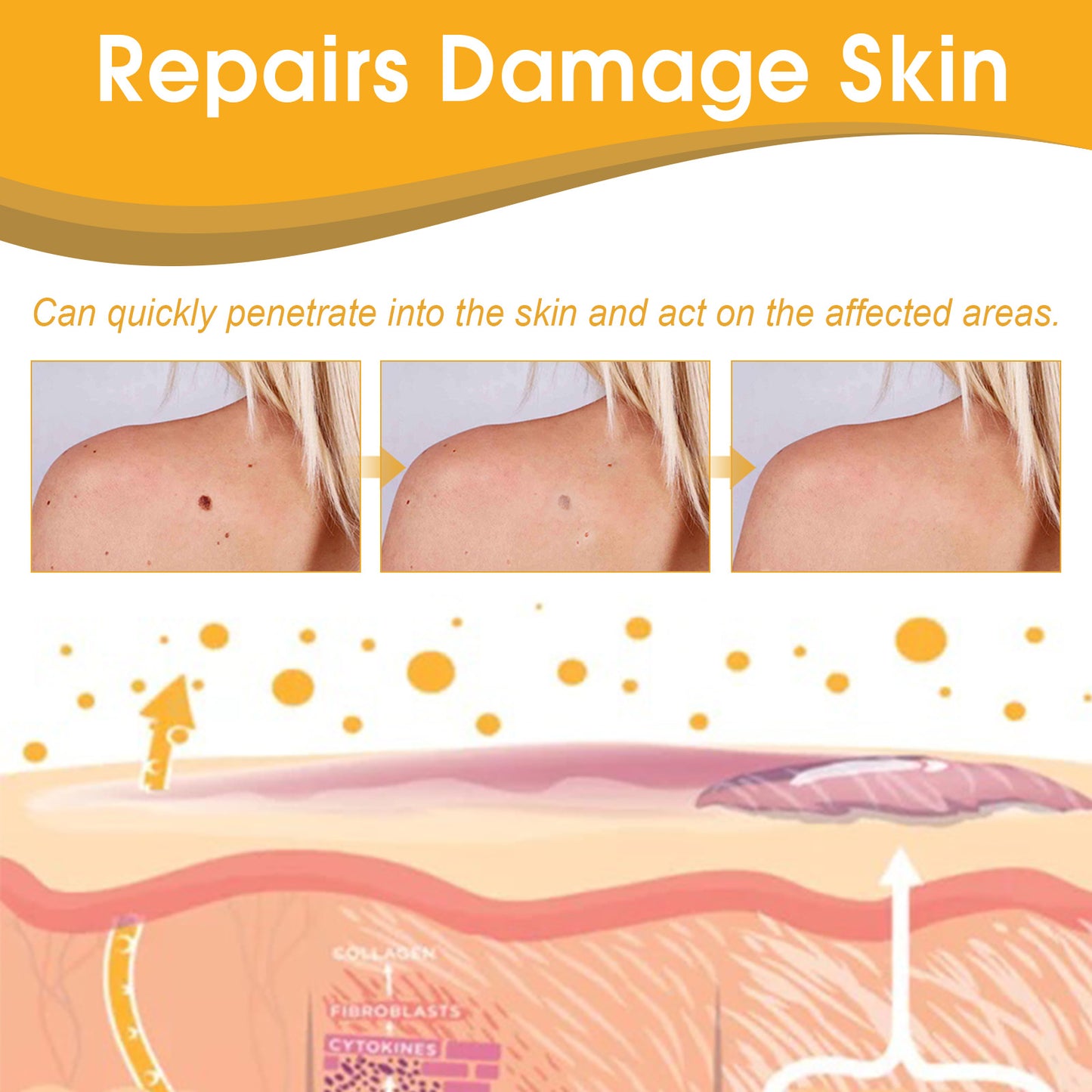 Fifuroes Beesvenom Wart Care Spray, Improves Flesh Particle Mole Repair Smooth Skin Wart Treatment Spray