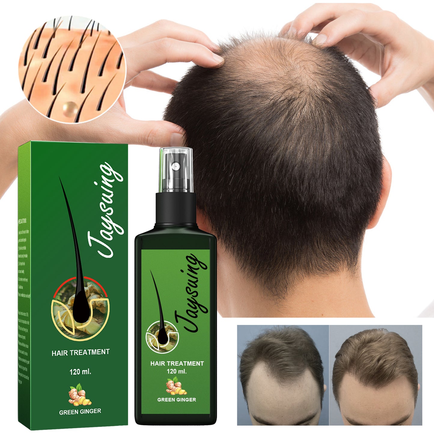 Fifuroes Hair Care Solution Gently Nourishes And Massages Scalp, Moisturizes And Softens Hair Care Spray