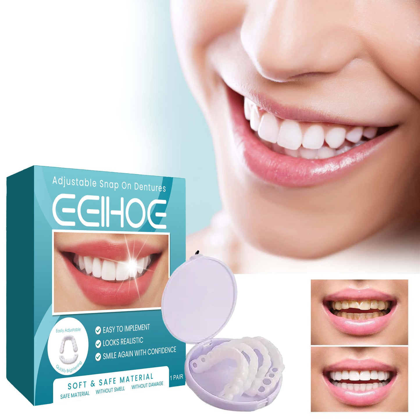 Fifuroes Adjustable Buckle Denture, Temporary Fillings Interdental Fillings Orthodontic Denture Kits