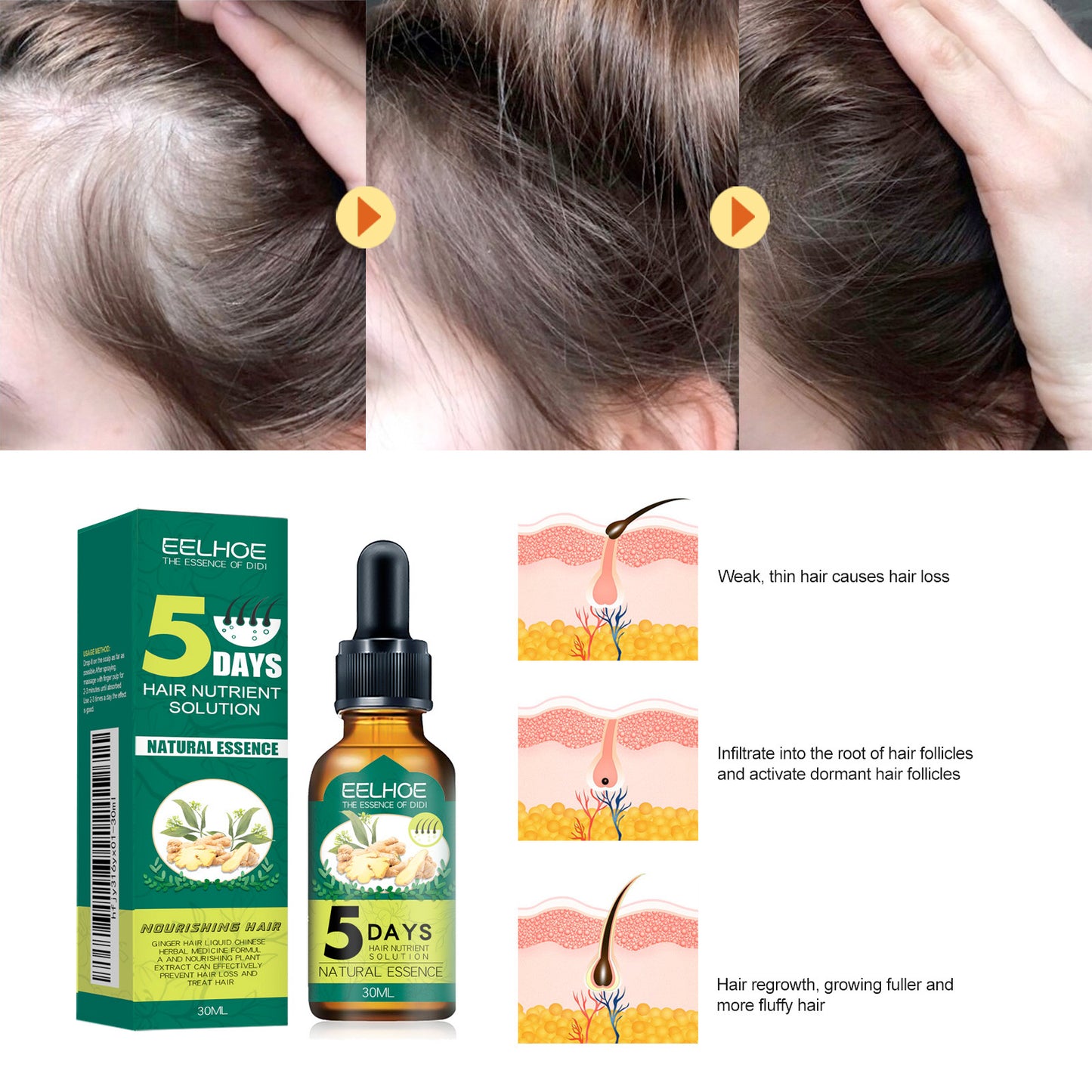 Fifuroes Ginger Hair Essential Oil Moisturizes And Softens Hair And Repairs Frizzy Damaged Hair