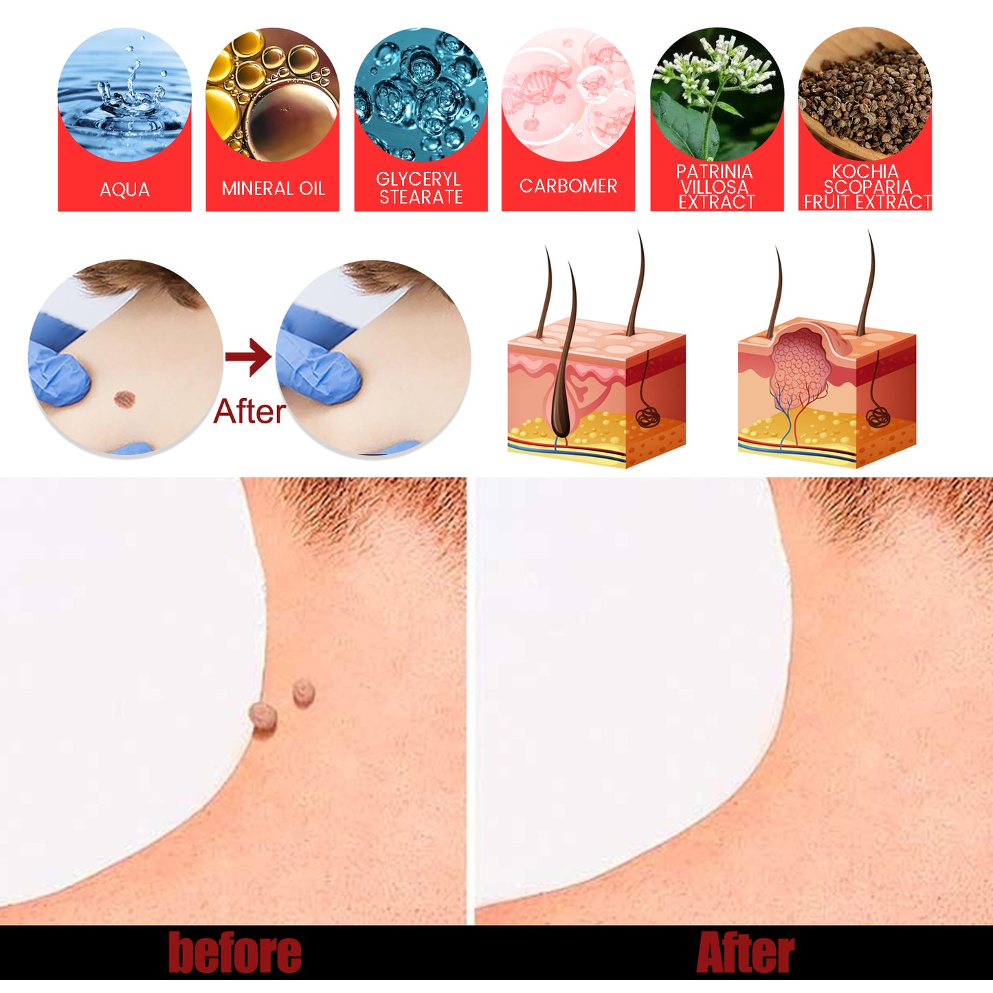 Fifuroes Keyu Care Cream Deep Cleansing Skin Smooth Skin Improve Skin Care Cream