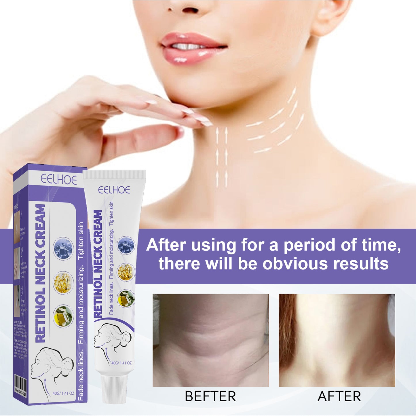 Fifuroes Retinol Neck Cream, Reduces Neck Lines, Moisturizes And Tightens Neck Skin Neck Massage Cream