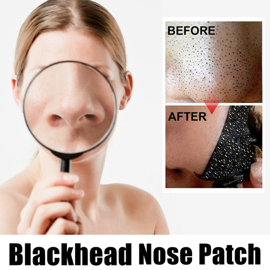 Fifuroes Black Pig Nose Patch, Bamboo Charcoal Remove Blackhead Acne Tear Nose Mask Patch