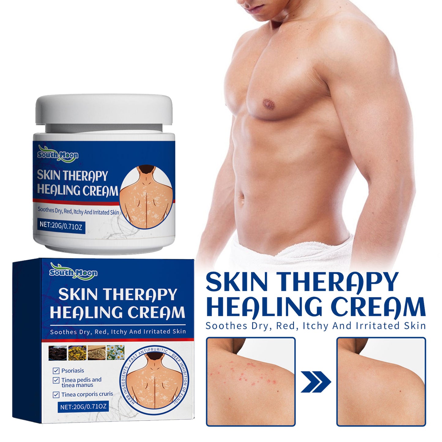 Fifuroes Skin Care Cream Gentle Ingredients Nourish Body Skin And Relieve Redness Skin Care Cream