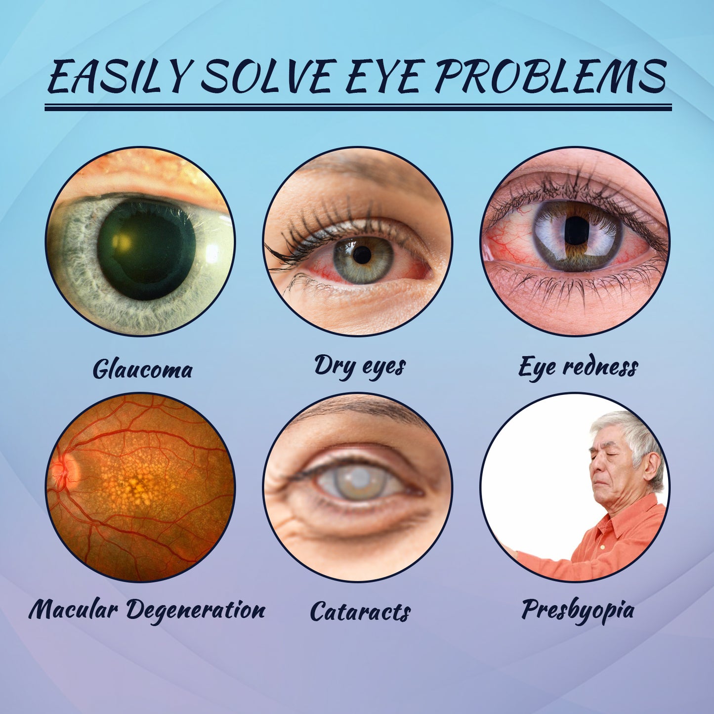 Fifuroes Lubricant Eye Drops, Relieve Redness Eye Fatigue Dryness Blurred Vision And Moisturize Eye Care Solution
