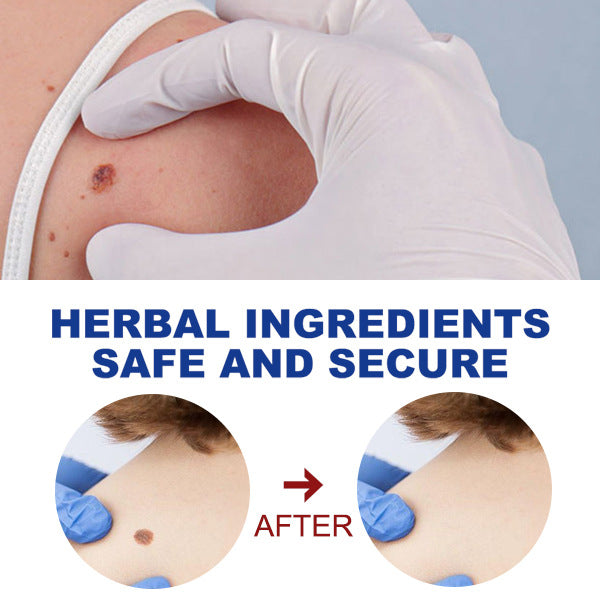 Fifuroes Kayu Liquid Pen Gently Cleanses Skin Care Body Face Label Meat Pellet Kayu Liquid