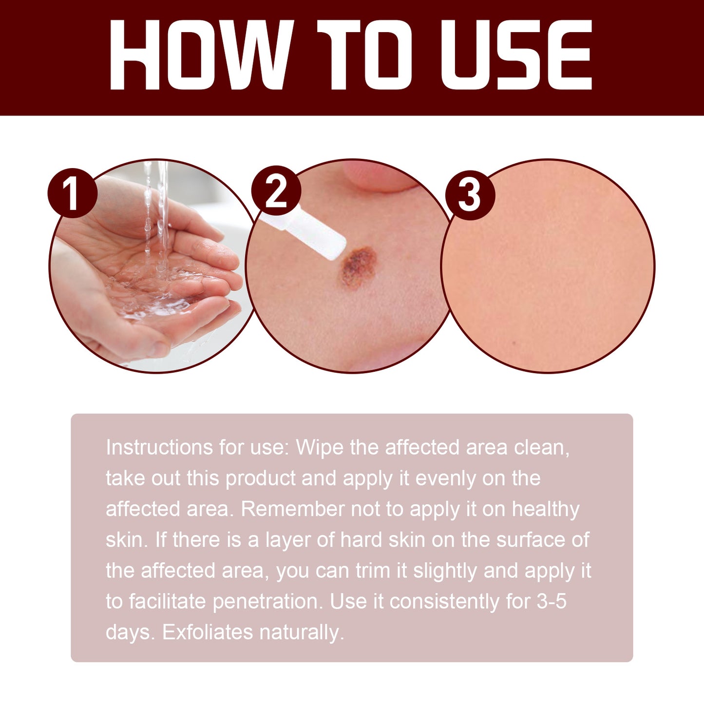 Fifuroes Wart Cream Pen, Skin Tags Gram Warts Fade Moles Corns Smooth Moisturizing Skin Repair