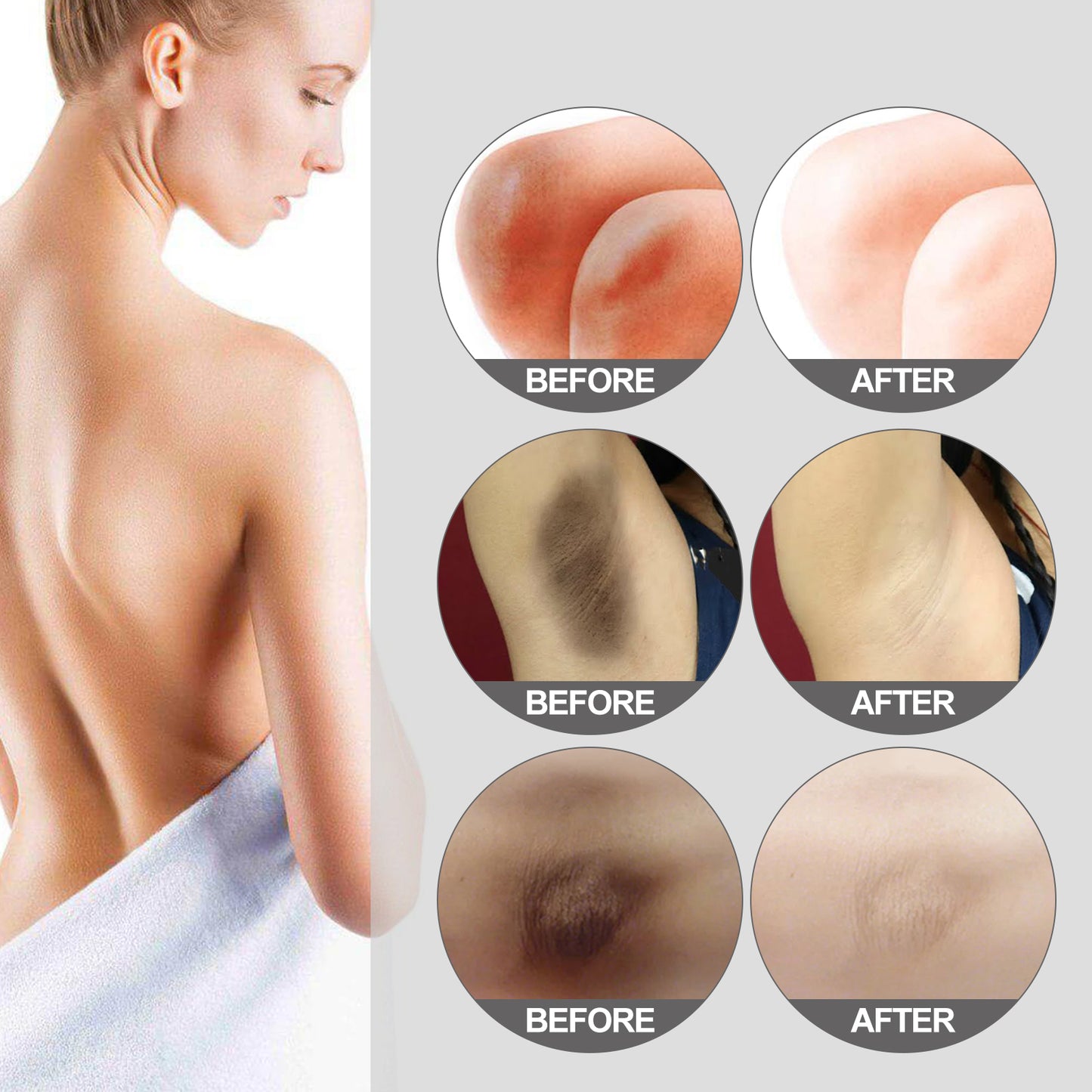 Fifuroes Thigh Radiance Moisturizing And Brightening Cream For Armpit Thighs And Knees