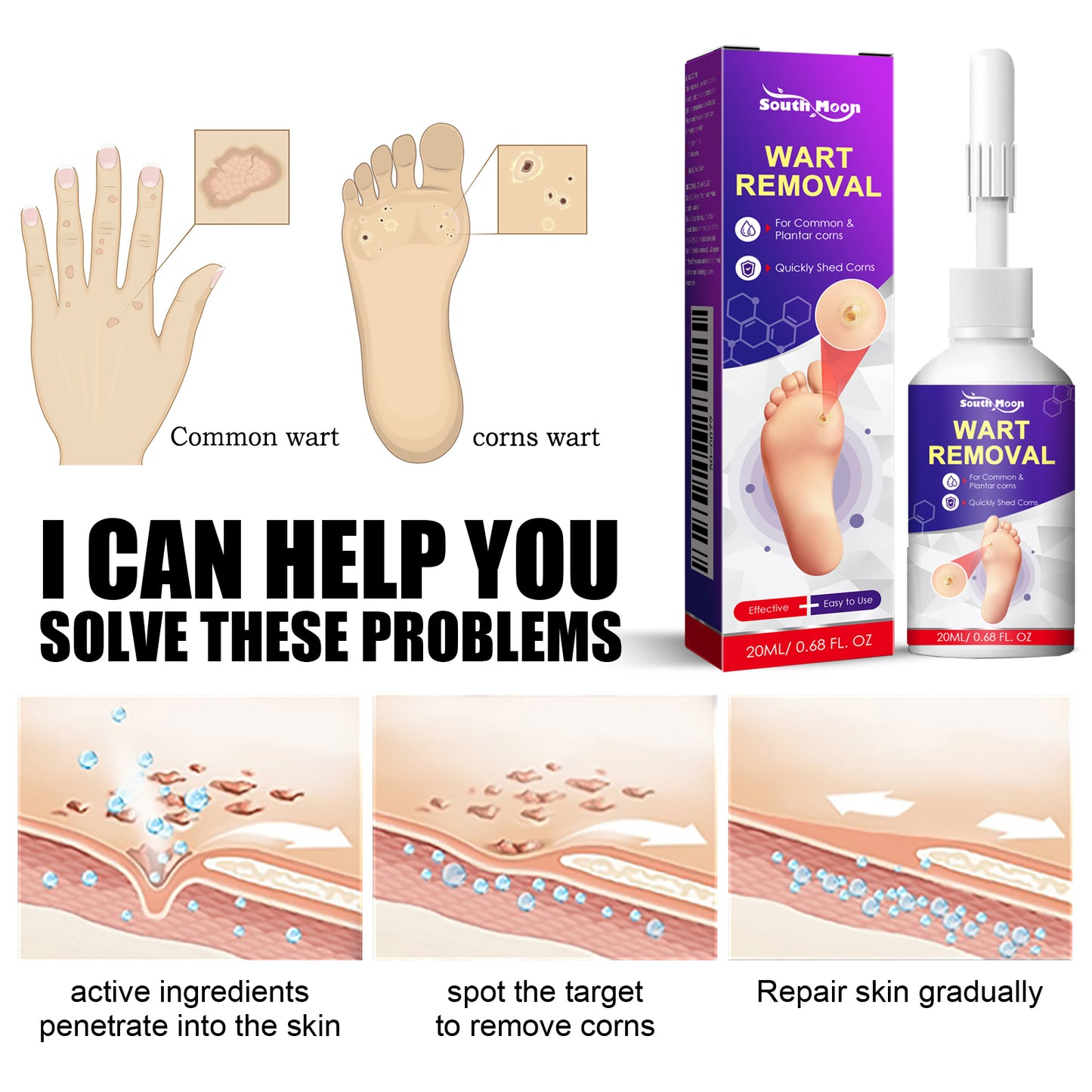 Fifuroes Remove Chicken Eye Lotion Extra Clear Remove Corns Skin Care Chicken Calluses Foot Pad Gram Warts
