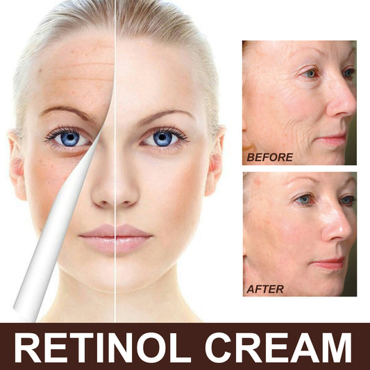 Fifuroes Retinol Cream, Anti-Aging Firming Brightening Moisturizing Facial Skin Care Cream