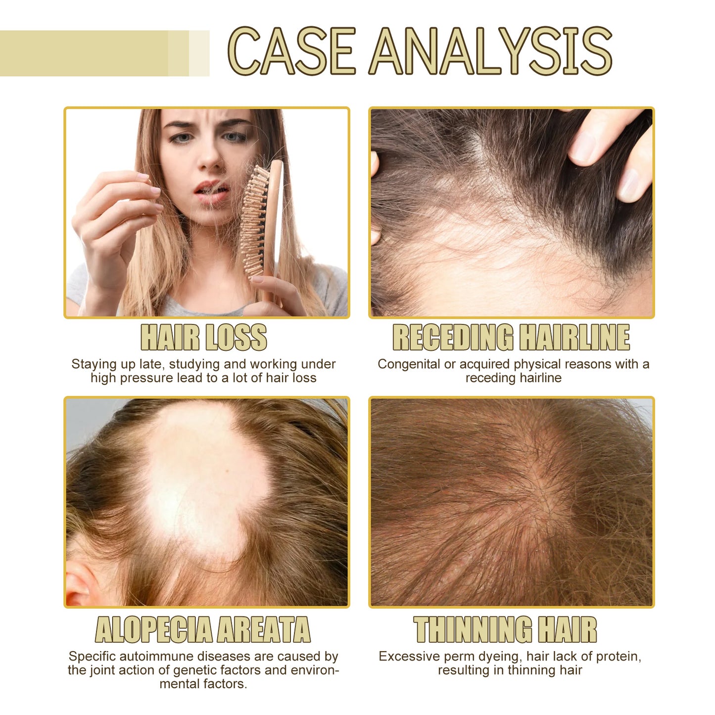 Fifuroes  Rosemary Essential Oil For Hair Care, Gentle And Nourishing Hair Care Oil