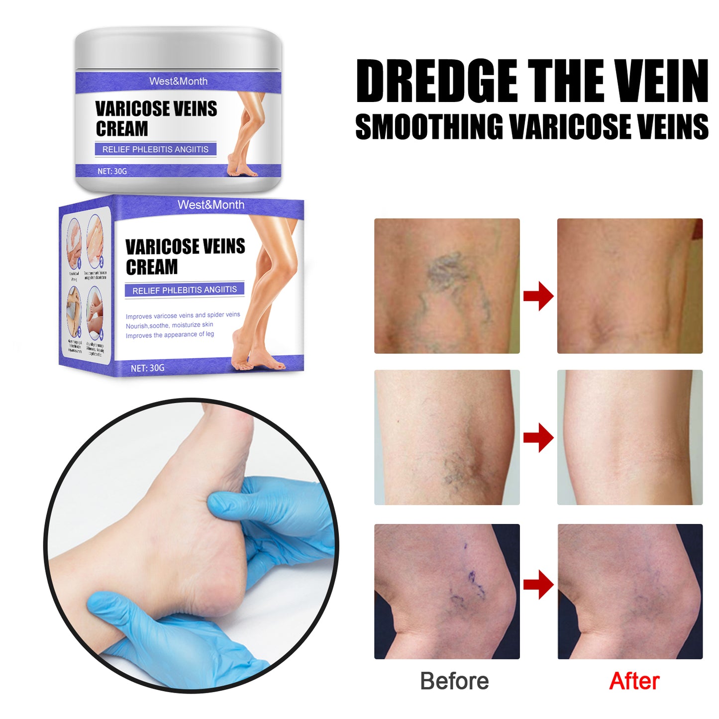Fifuroes Leg Care Cream Gentle Care For Leg Discomfort Daily Moisturizing Maintenance Topical Massage Cream