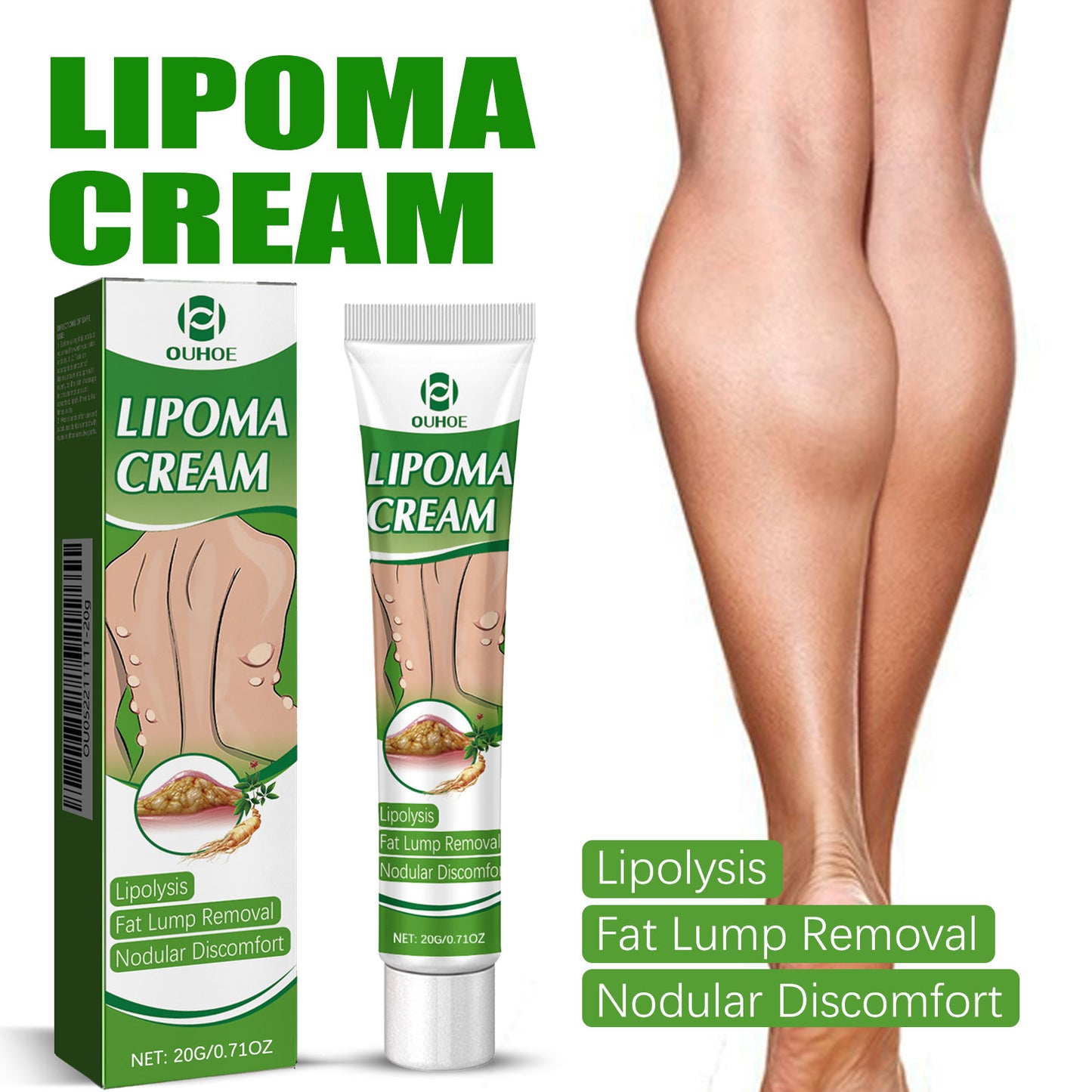 Fifuroes Fat Binding Cream, Dredge Body Of Many Kinds Of Fat Caking Tumor Subcutaneous Lumps Body Care Cream