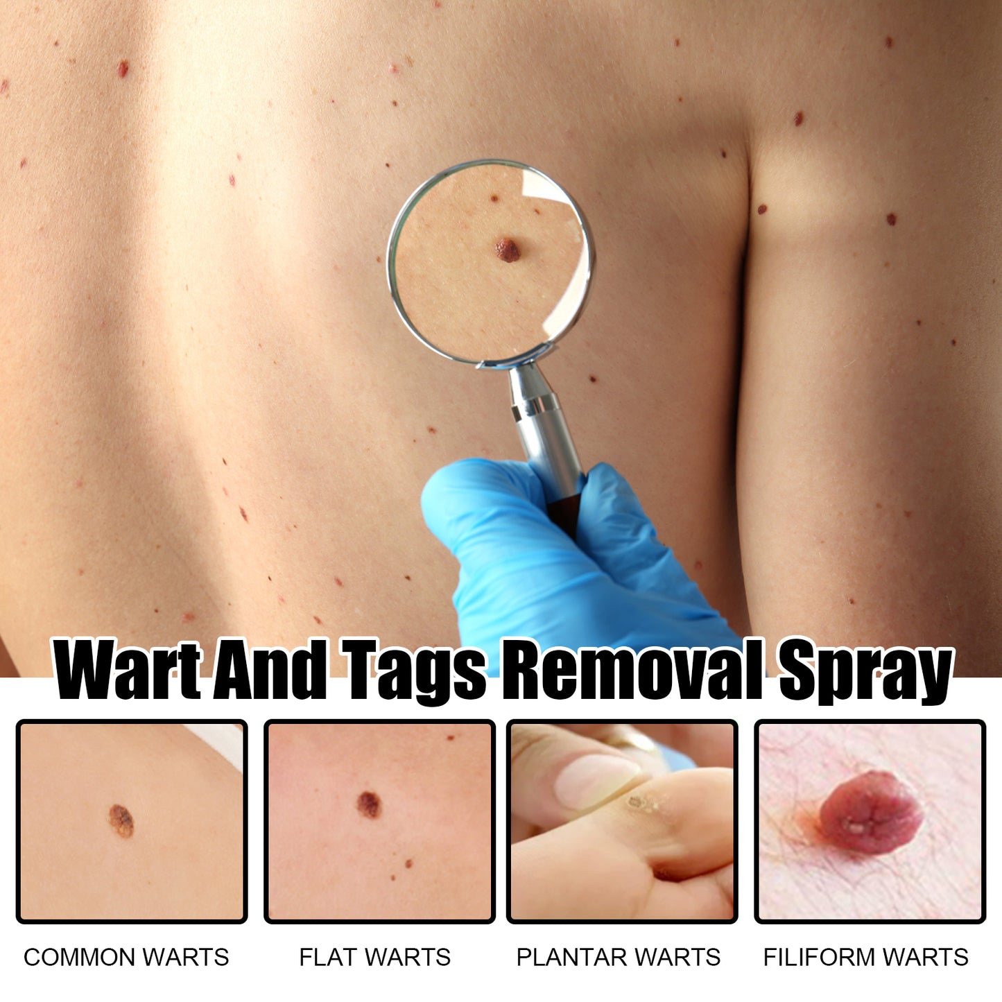 Fifuroes Wart And Tags Removal Spray, Cleanse And Fade Body Moles Smooth Skin Repair Spray