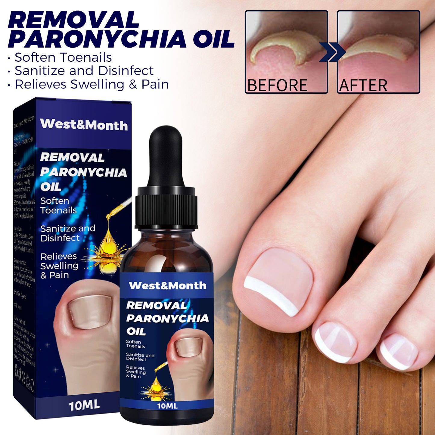 Fifuroes Nail Repair Oil Hand And Foot Repair Inlaid Toenails Soft Nails Daily Moisturizing Nail Care