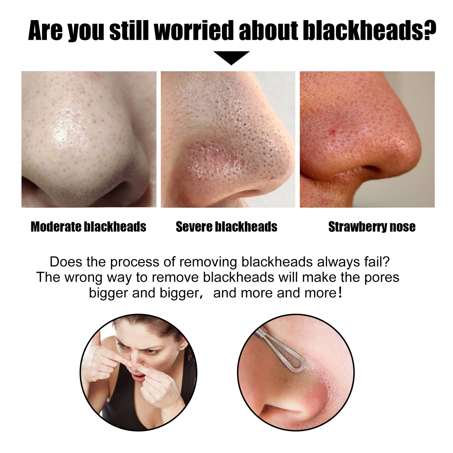 Fifuroes Black Pig Nose Patch, Bamboo Charcoal Remove Blackhead Acne Tear Nose Mask Patch