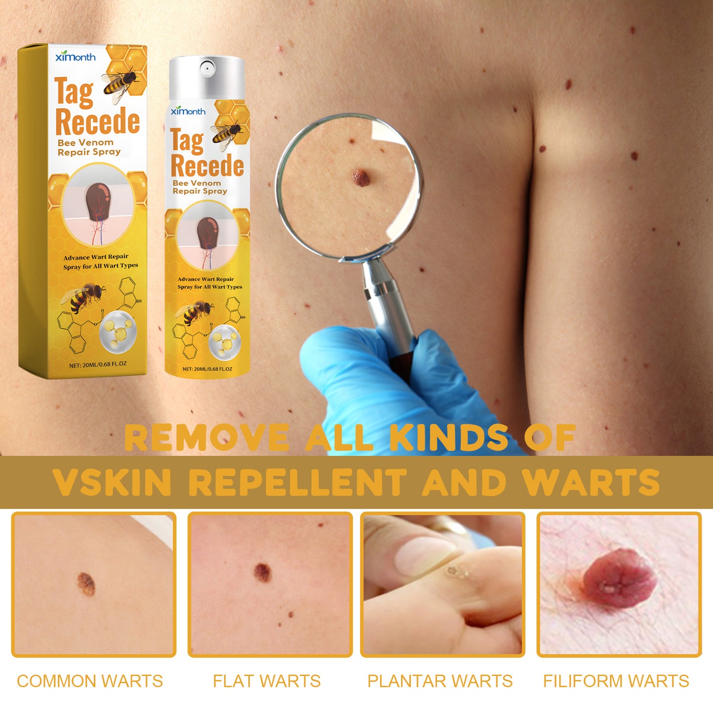 Fifuroes Beesvenom Wart Care Spray, Improves Flesh Particle Mole Repair Smooth Skin Wart Treatment Spray