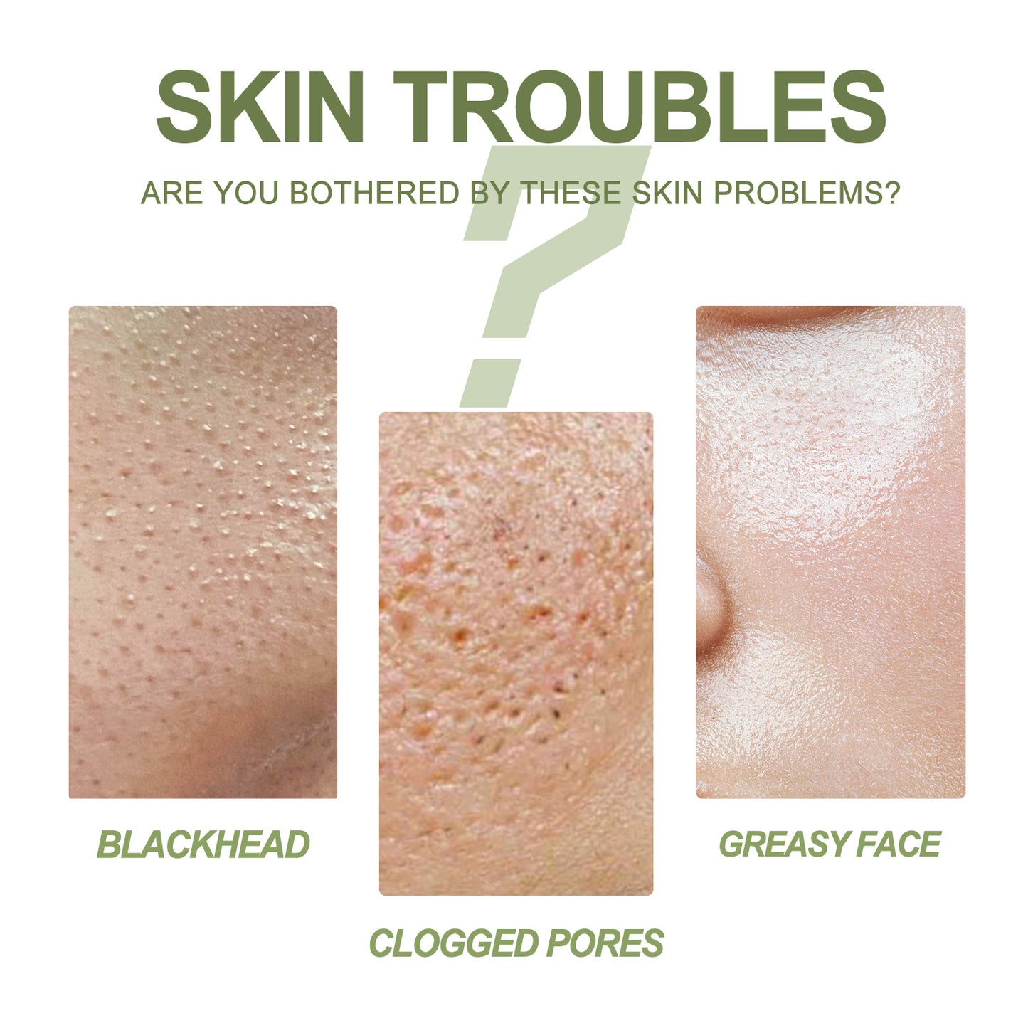 Fifuroes Blackhead Removing Serum Suit, Clean Pores Fine Oil Control Clean Repair Acne Blackhead Nose Patch