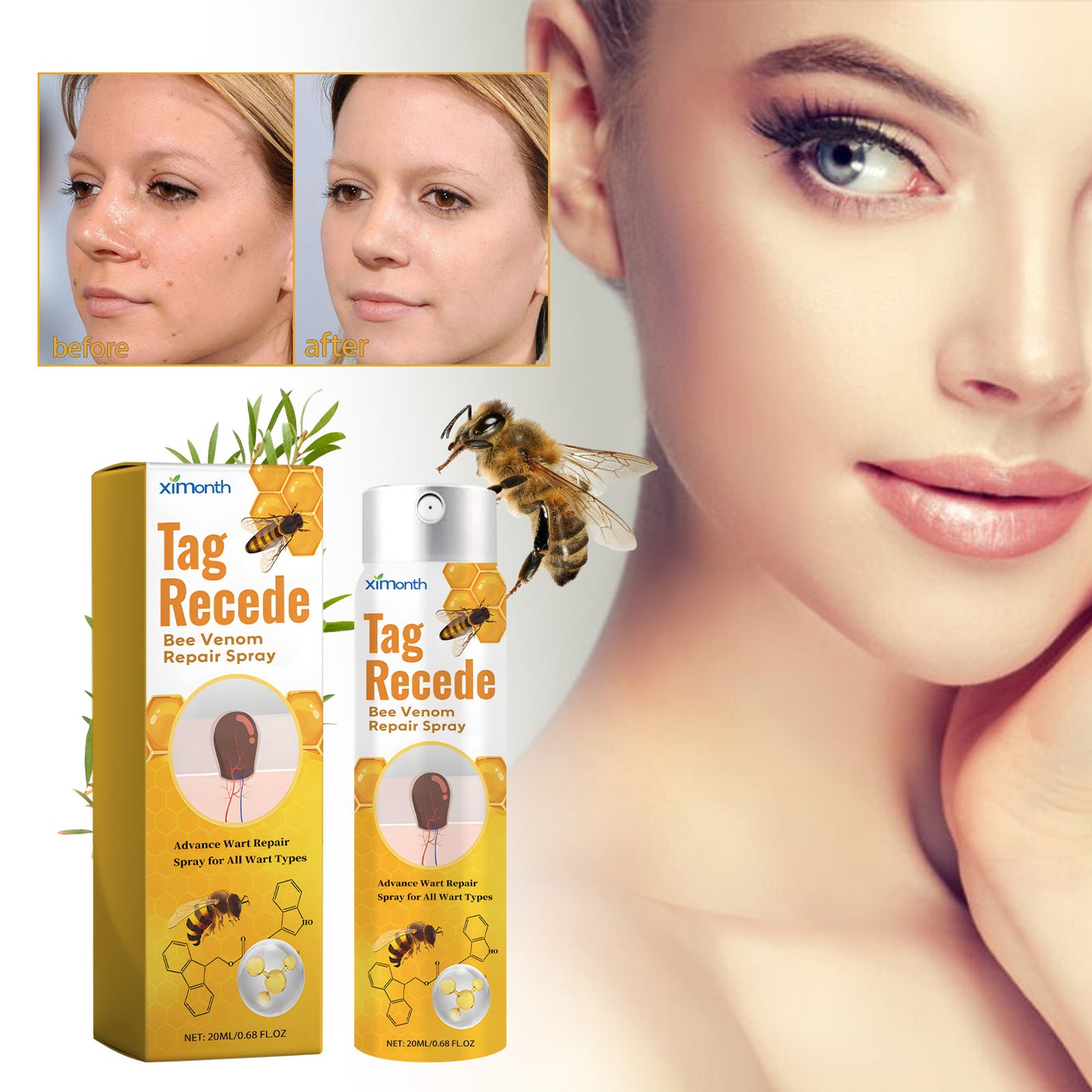Fifuroes Beesvenom Wart Care Spray, Improves Flesh Particle Mole Repair Smooth Skin Wart Treatment Spray