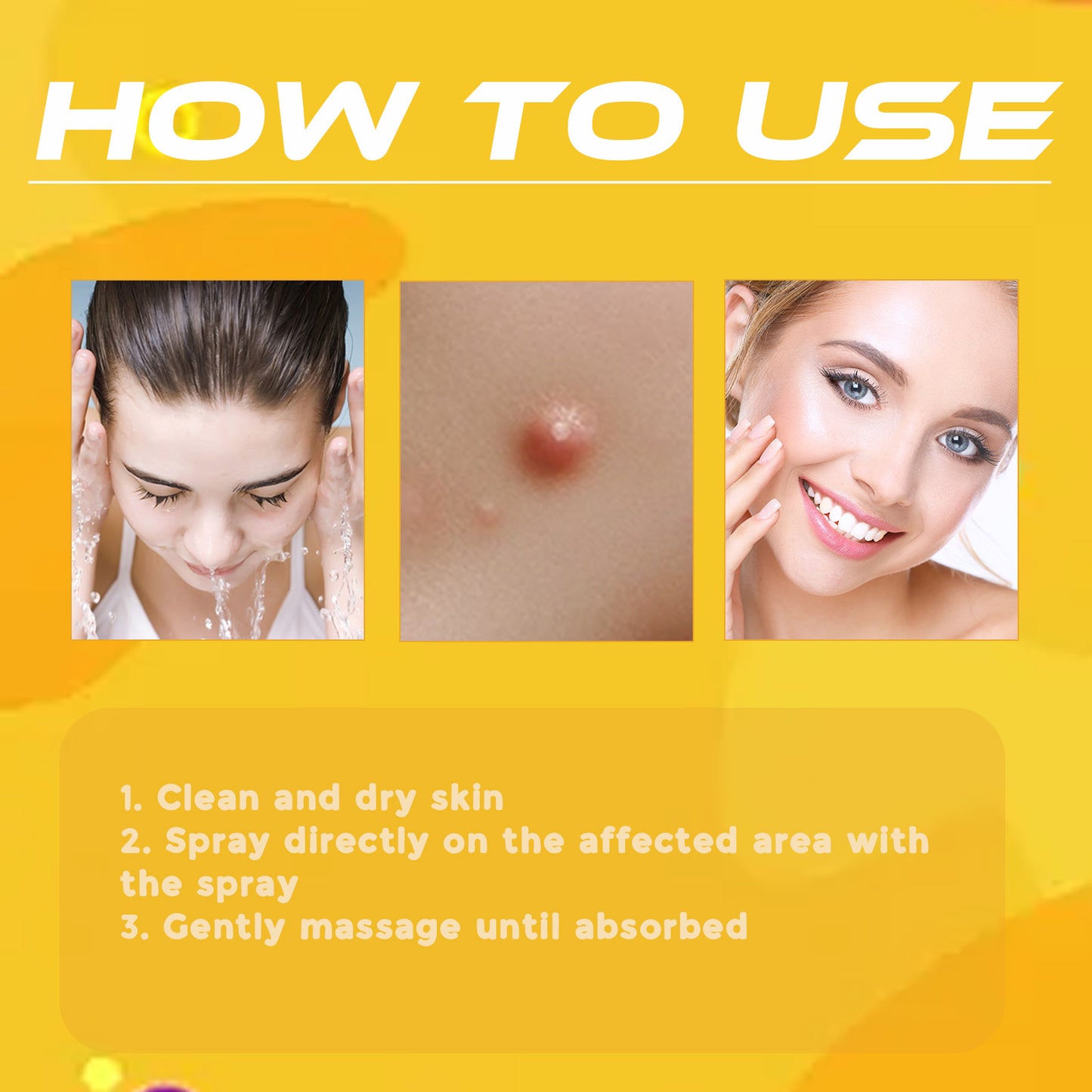 Fifuroes Beesvenom Wart Care Spray, Improves Flesh Particle Mole Repair Smooth Skin Wart Treatment Spray