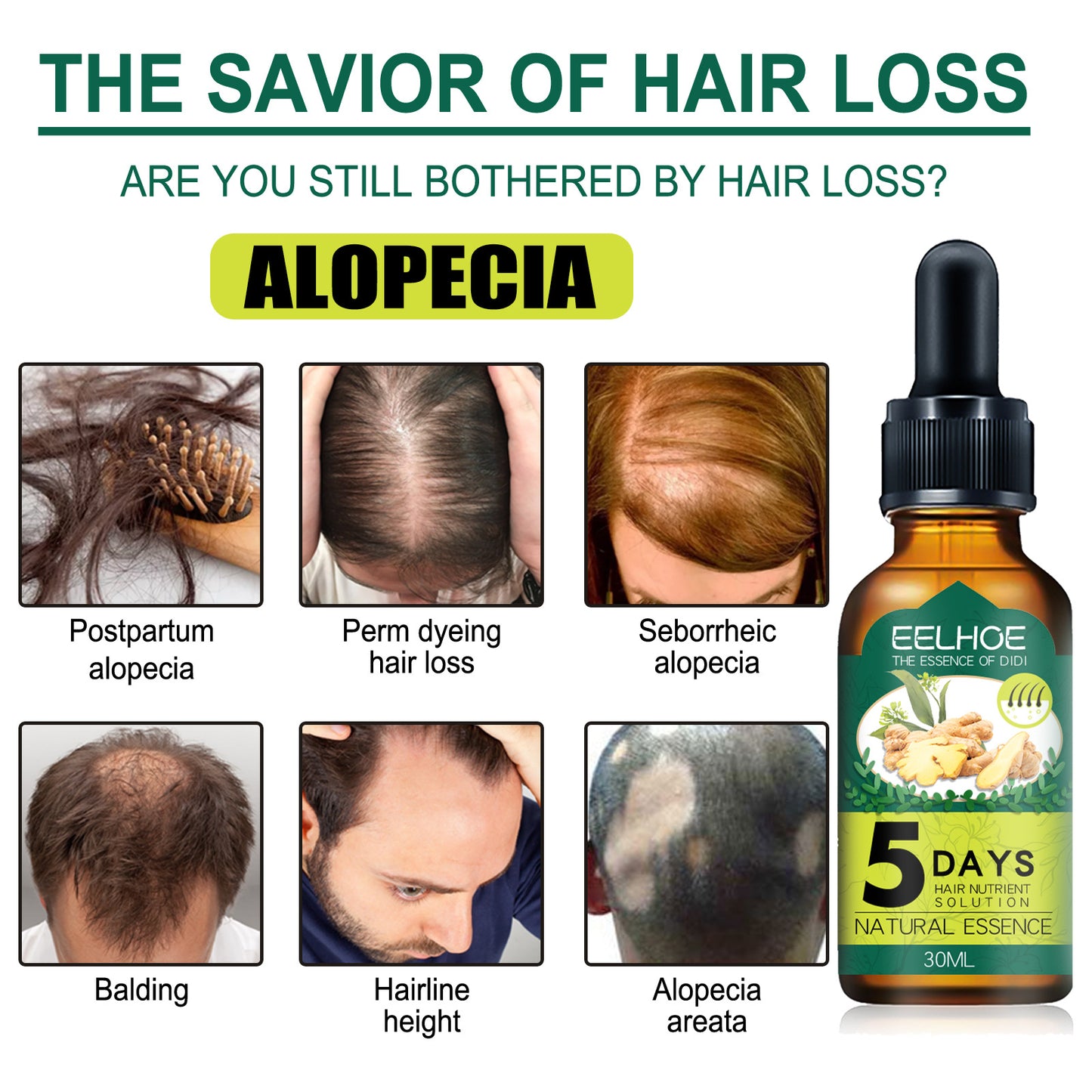 Fifuroes Ginger Hair Essential Oil Moisturizes And Softens Hair And Repairs Frizzy Damaged Hair