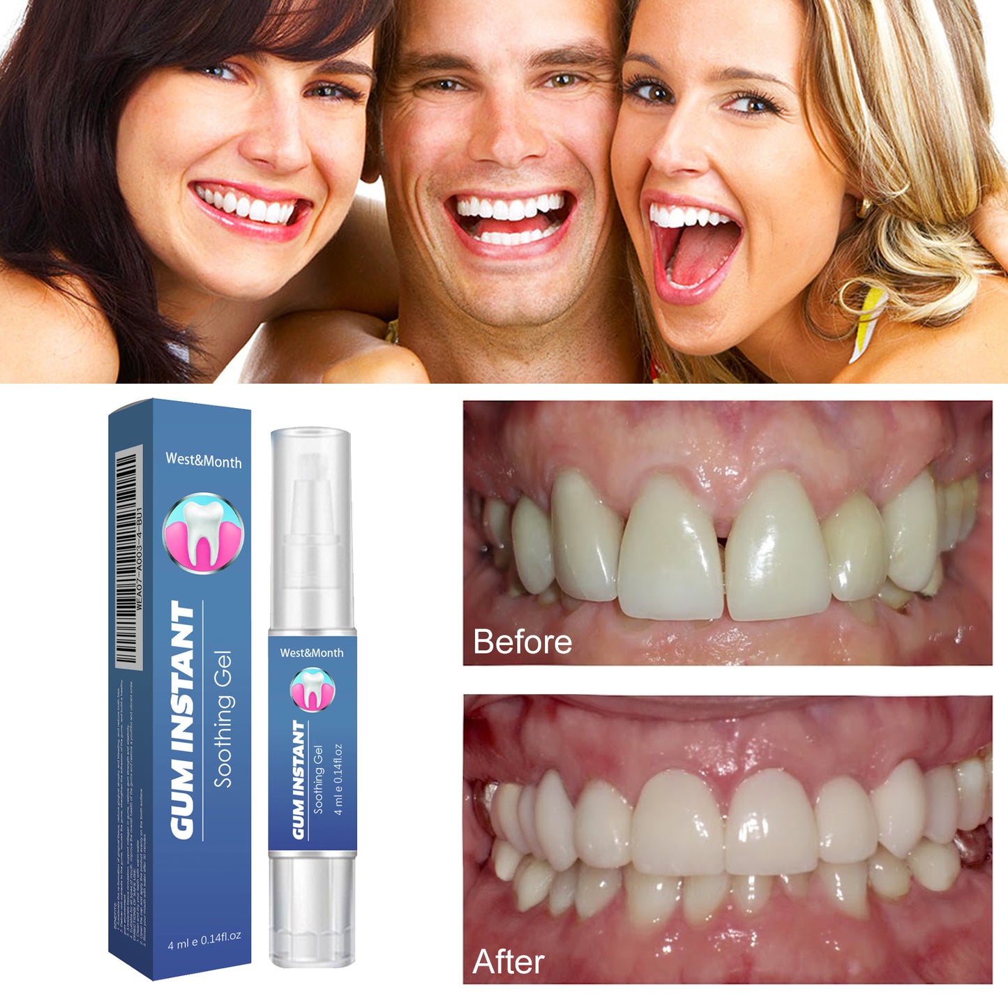 Fifuroes Gum Instant Soothing Gel, Relieve Gums Swelling And Pain Clean Teeth Plaque Stains And Whiten Teeth Gel