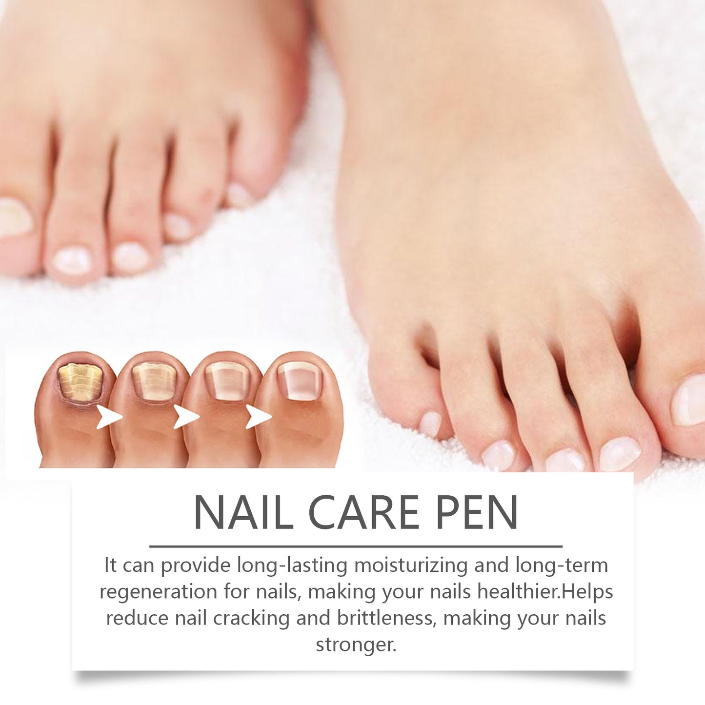 Fifuroes Gray Nail Care Pen Hand And Foot Gray Nail Nutrition Care Bright Nail Nail Thick Toe Care Pen