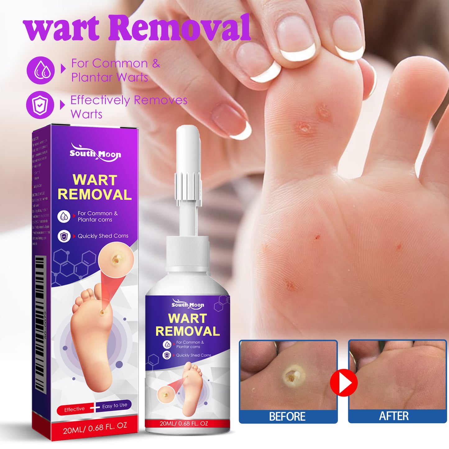 Fifuroes Remove Chicken Eye Lotion Extra Clear Remove Corns Skin Care Chicken Calluses Foot Pad Gram Warts