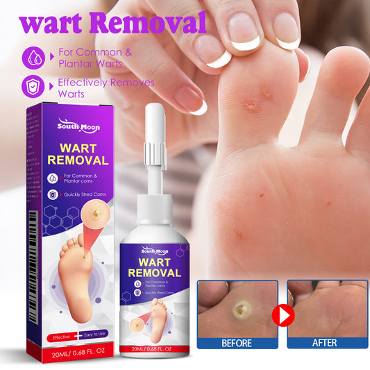 Fifuroes Remove Chicken Eye Lotion Extra Clear Remove Corns Skin Care Chicken Calluses Foot Pad Gram Warts