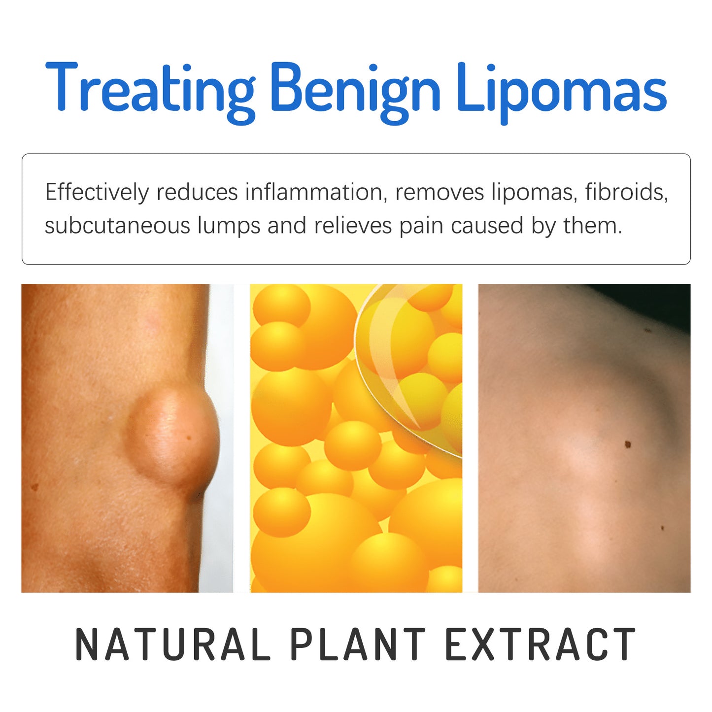 Fifuroes Body Care Cream Gentle Daily Nourishing Relief Of Physical Discomfort Leg Repair Cream